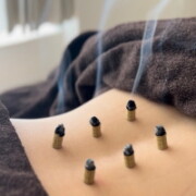 鍼灸治療 鍼灸治療